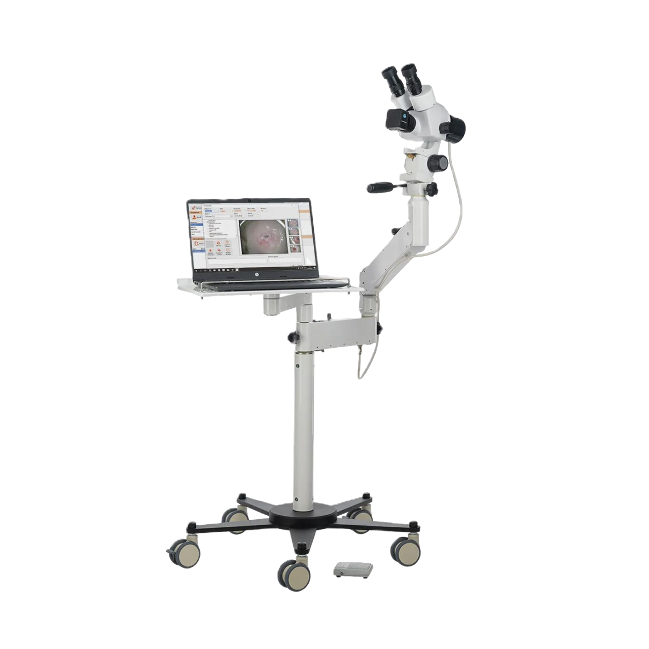 Видеокомплекс для кольпоскопов ZMir КС-02 ZOOM Комфорт