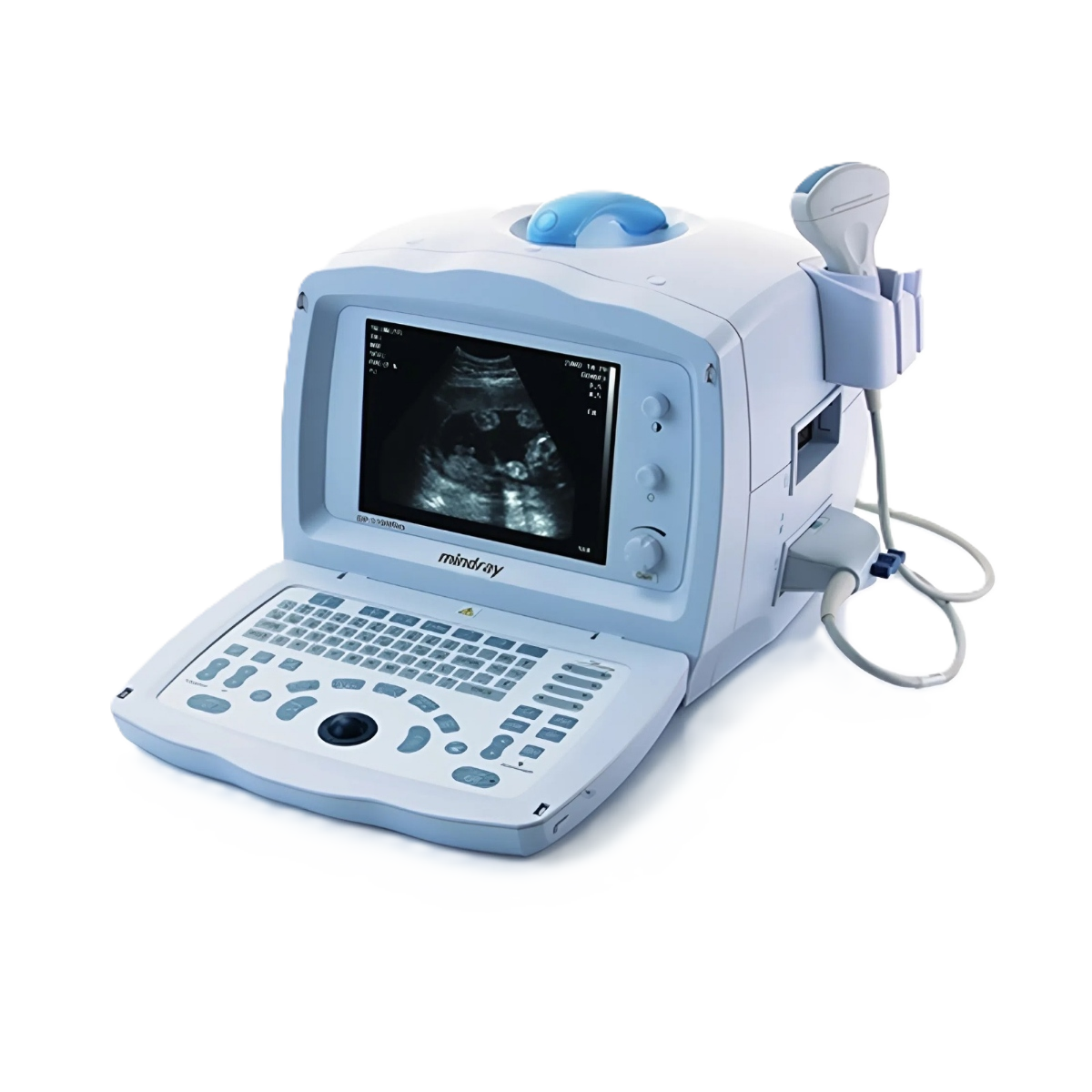 УЗИ аппарат Mindray DP 1100