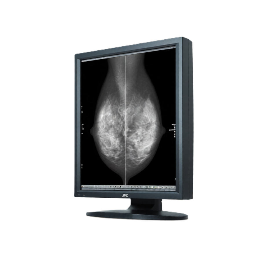 Медицинский монитор JVC MS55i2 plus