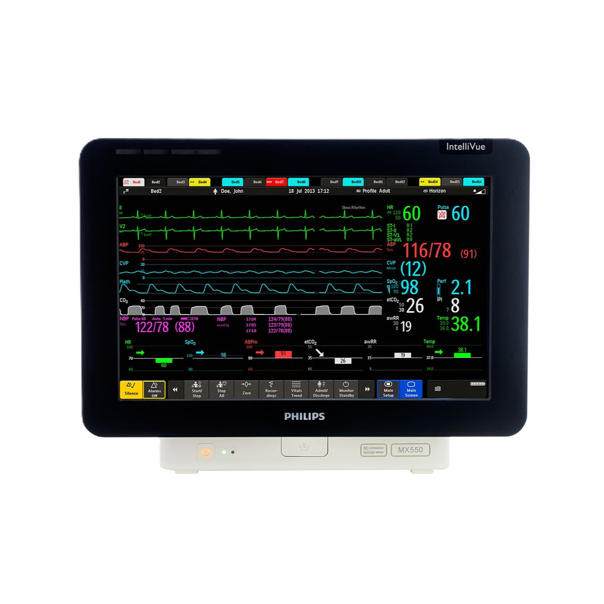 Монитор пациента Philips IntelliVue MX550