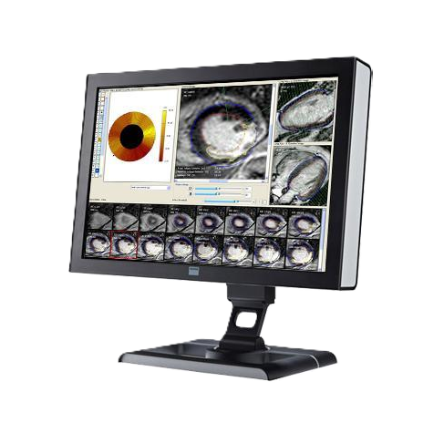 ПО для магнитно-резонансного анализа желудочков Esaote CAAS MRV