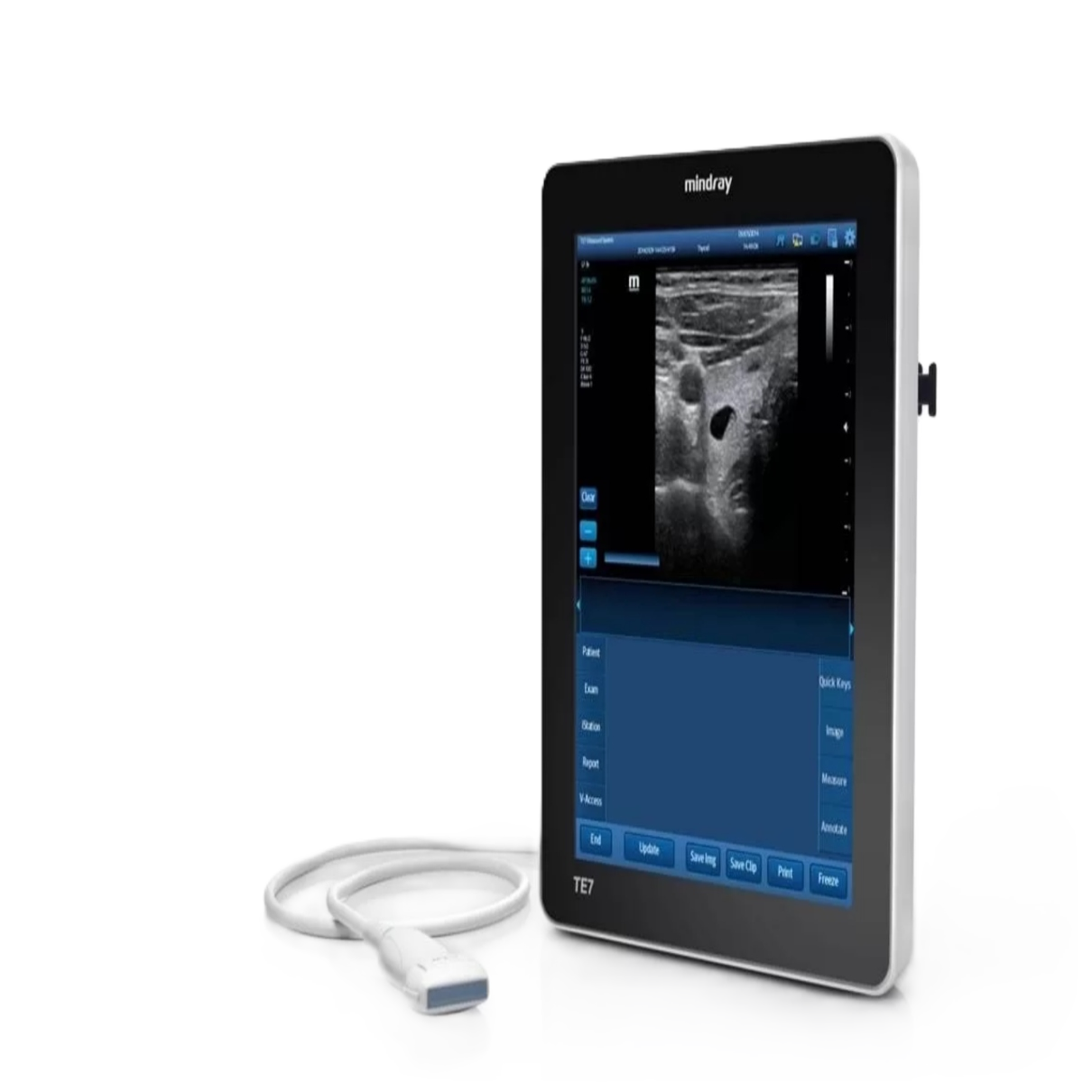 Портативная ультразвуковая система Mindray TE7 (планшет УЗИ)
