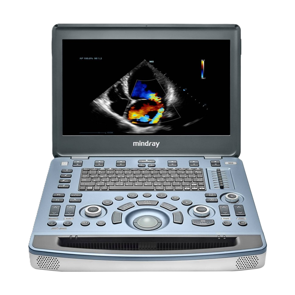 УЗИ аппарат Mindray M8 портативный