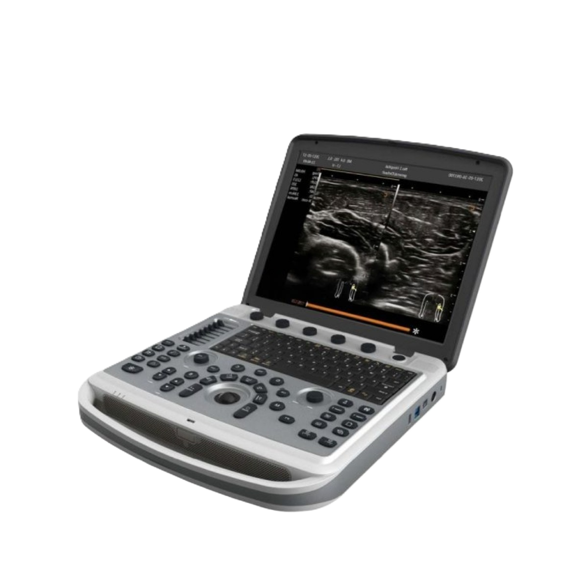 УЗИ аппарат Chison SonoTouch 80 (SonoBook 6)