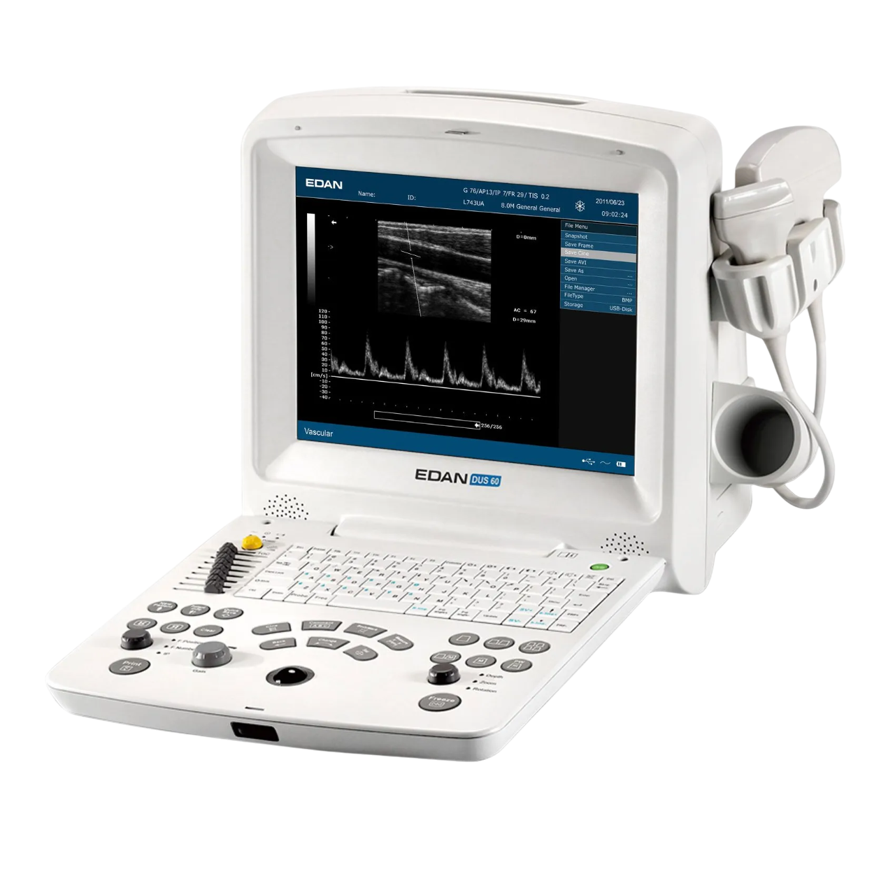 Аппарат УЗИ Edan Dus 60
