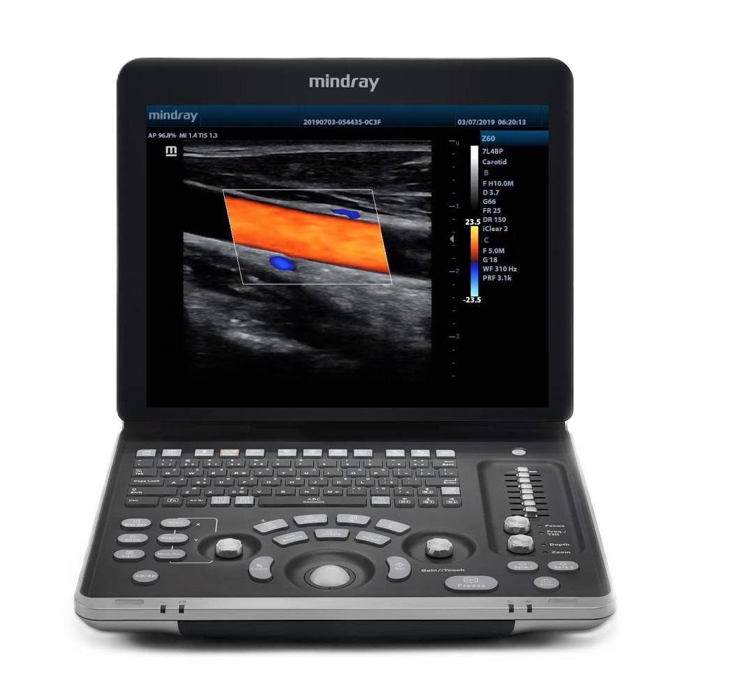 Ветеринарный УЗИ-сканер Mindray Z60 Vet