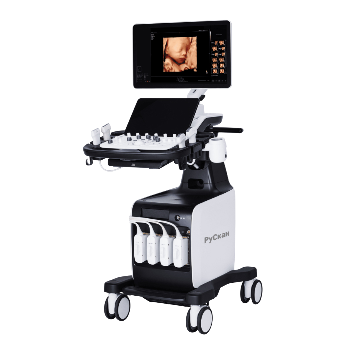 УЗИ аппарат РуСкан 80