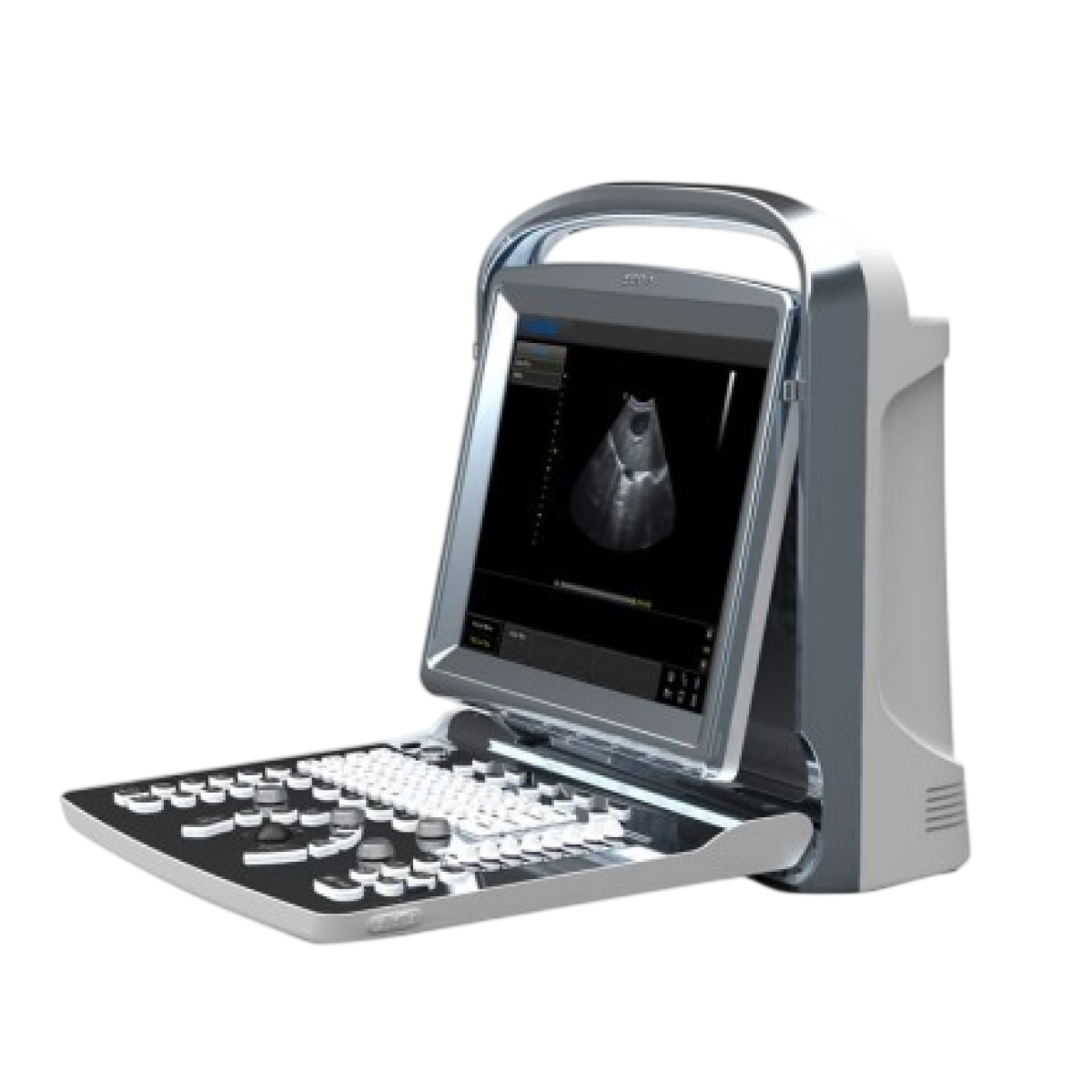 УЗИ аппарат CHISON ECO 1