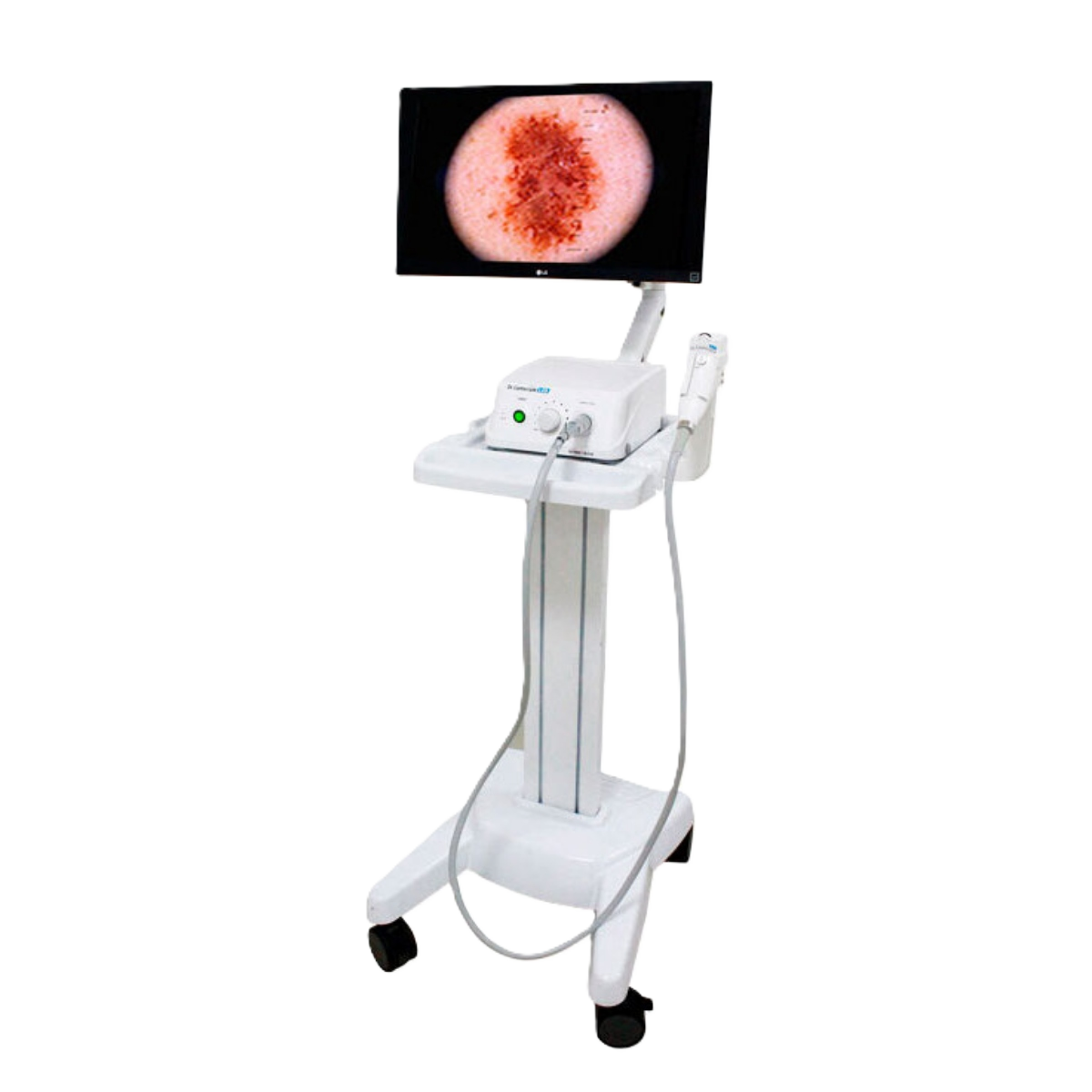Видеодерматоскоп Sometech Dr. Camscope DCS-105