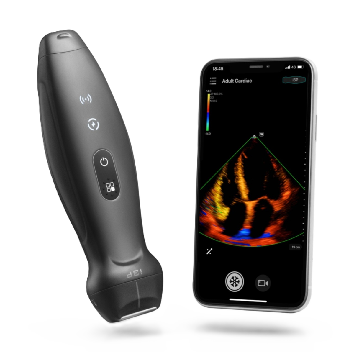 УЗИ аппарат Mindray ТЕ Air i3P