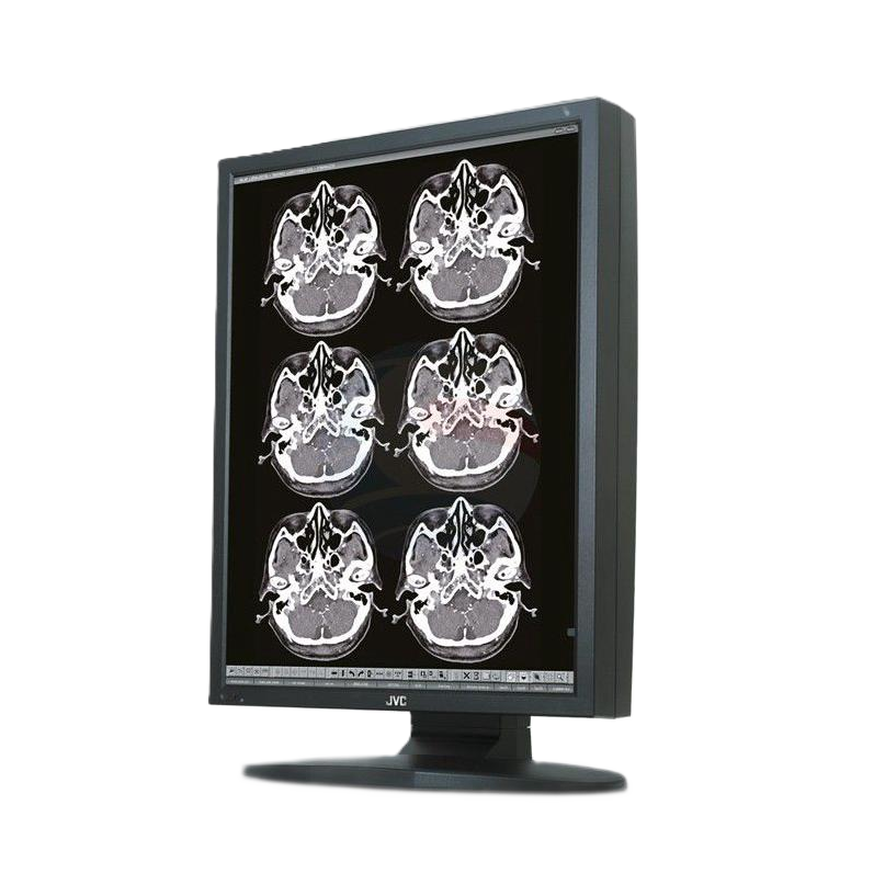 Медицинский монитор JVC MS35i2