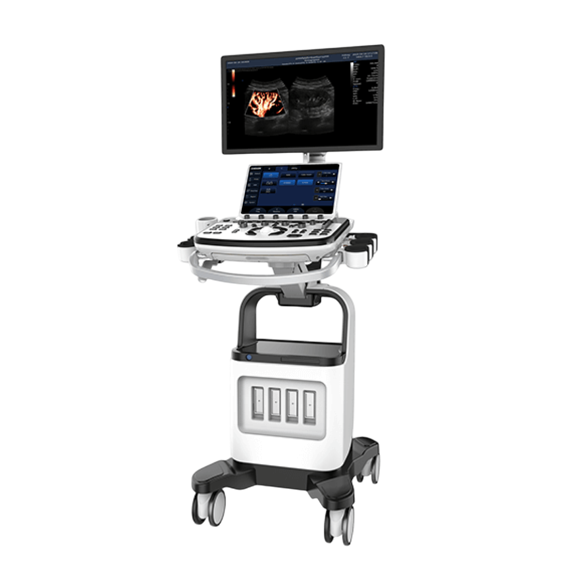 Стационарный УЗИ аппарат Chison Qbit 12 (XBit 90)