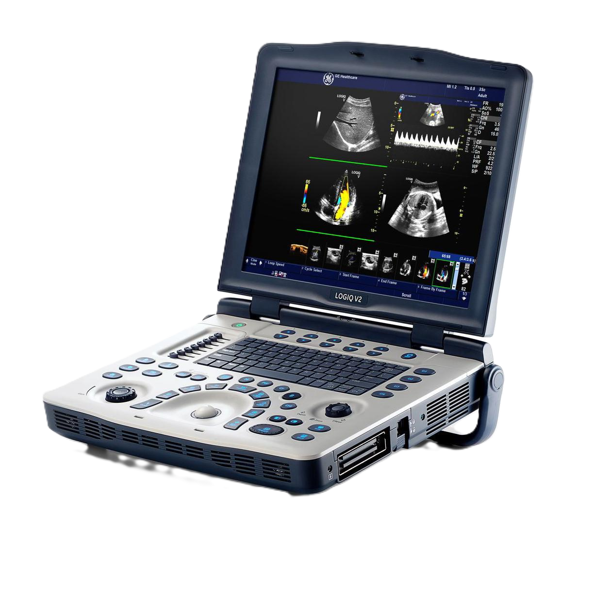 Ультразвуковая диагностическая система GE Healthcare LOGIQ V2
