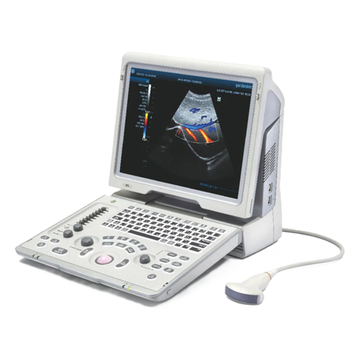 УЗИ аппарат Mindray DP-50 Color