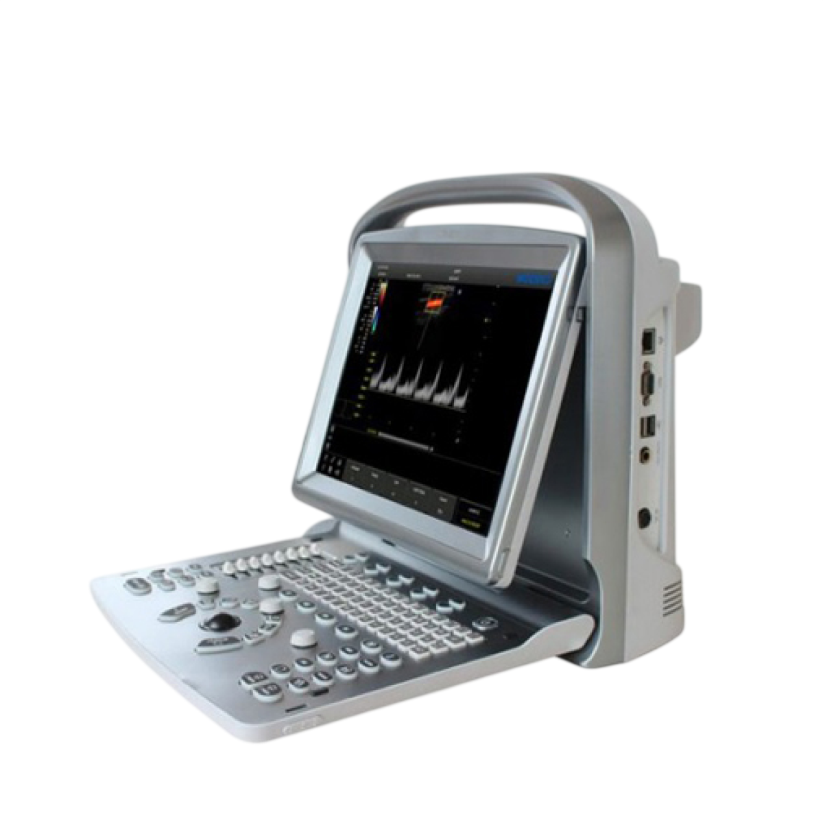 УЗИ аппарат CHISON ECO 5